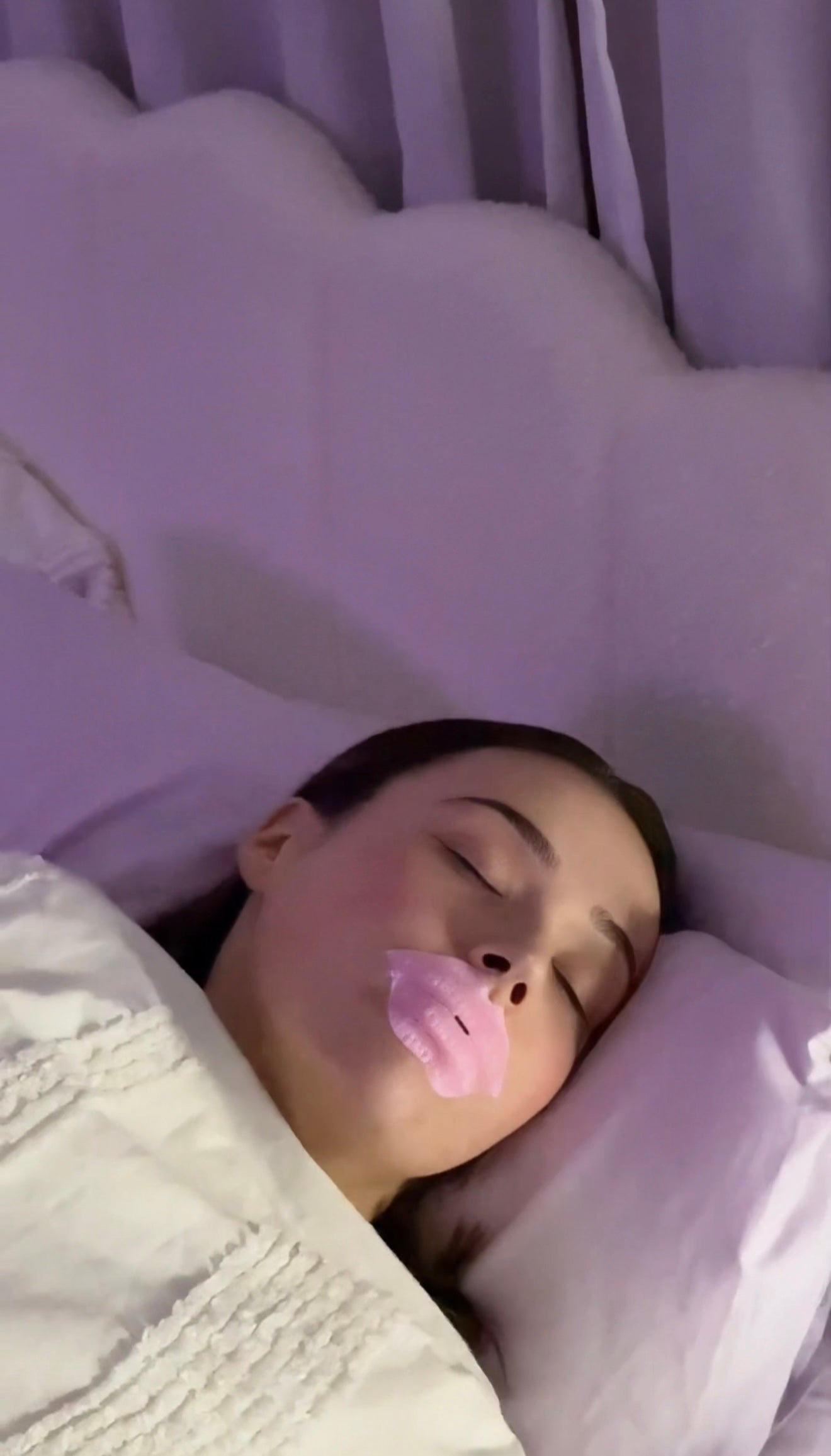 Alma Skin™ - Hydrating & Plumping Mouth Tape