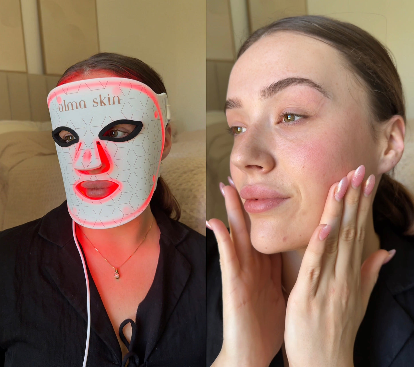 Alma Skin™ - Near Infrared Light Therapy Mask