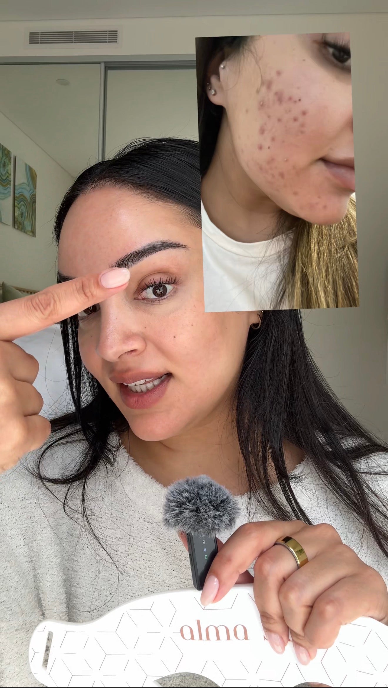 Alma Skin™ - Near Infrared Light Therapy Mask