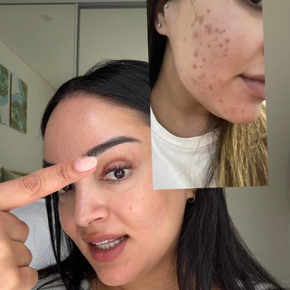 Alma Skin™ - Near Infrared Light Therapy Mask