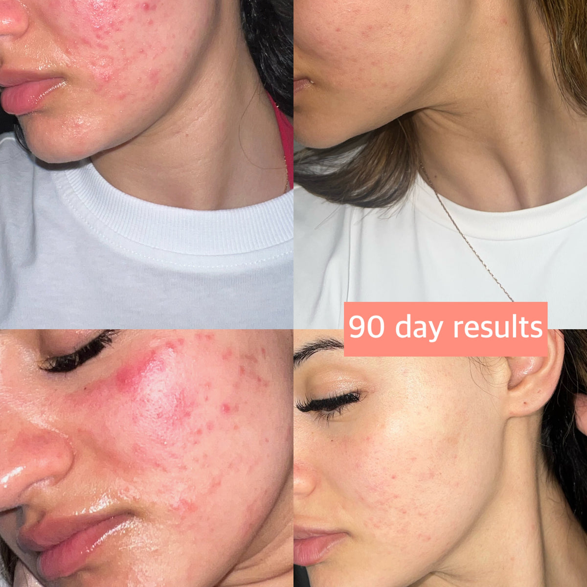 Alma Skin™ - Near Infrared Light Therapy Mask