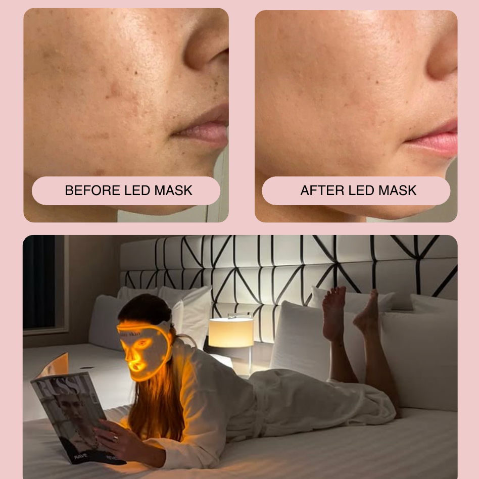 Alma Skin™ - Near Infrared Light Therapy Mask